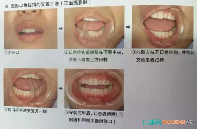 拍不好口腔照片怎么辦？這些口腔攝影方法與技巧請(qǐng)收好！