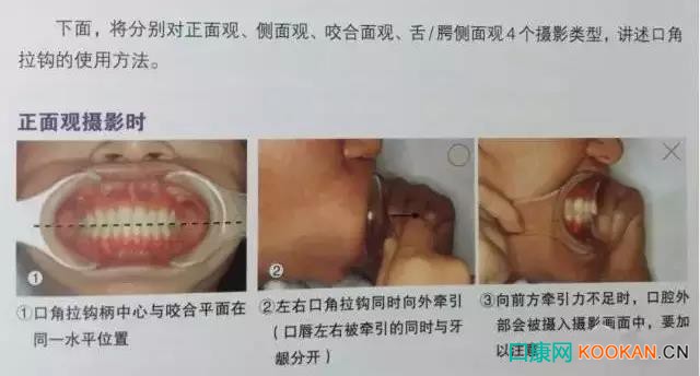 拍不好口腔照片怎么辦？這些口腔攝影方法與技巧請(qǐng)收好！