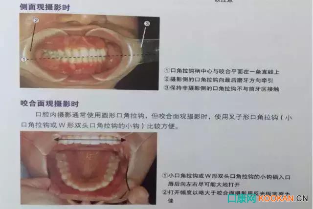 拍不好口腔照片怎么辦？這些口腔攝影方法與技巧請(qǐng)收好！