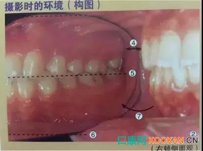 拍不好口腔照片怎么辦？這些口腔攝影方法與技巧請(qǐng)收好！