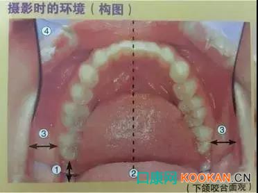 拍不好口腔照片怎么辦？這些口腔攝影方法與技巧請(qǐng)收好！