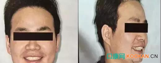 拍不好口腔照片怎么辦？這些口腔攝影方法與技巧請(qǐng)收好！