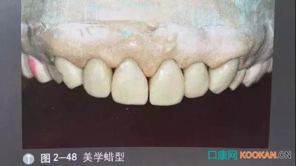 拍不好口腔照片怎么辦？這些口腔攝影方法與技巧請(qǐng)收好！