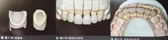 拍不好口腔照片怎么辦？這些口腔攝影方法與技巧請(qǐng)收好！